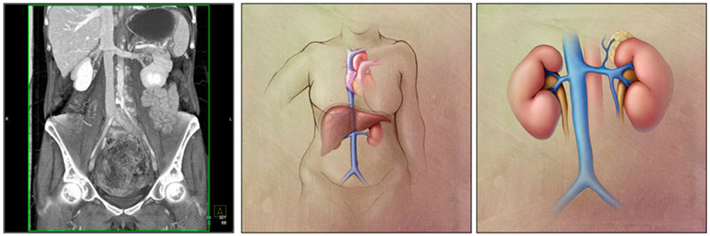 Normal Anatomy